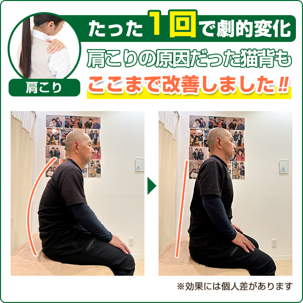 ビフォーアフター